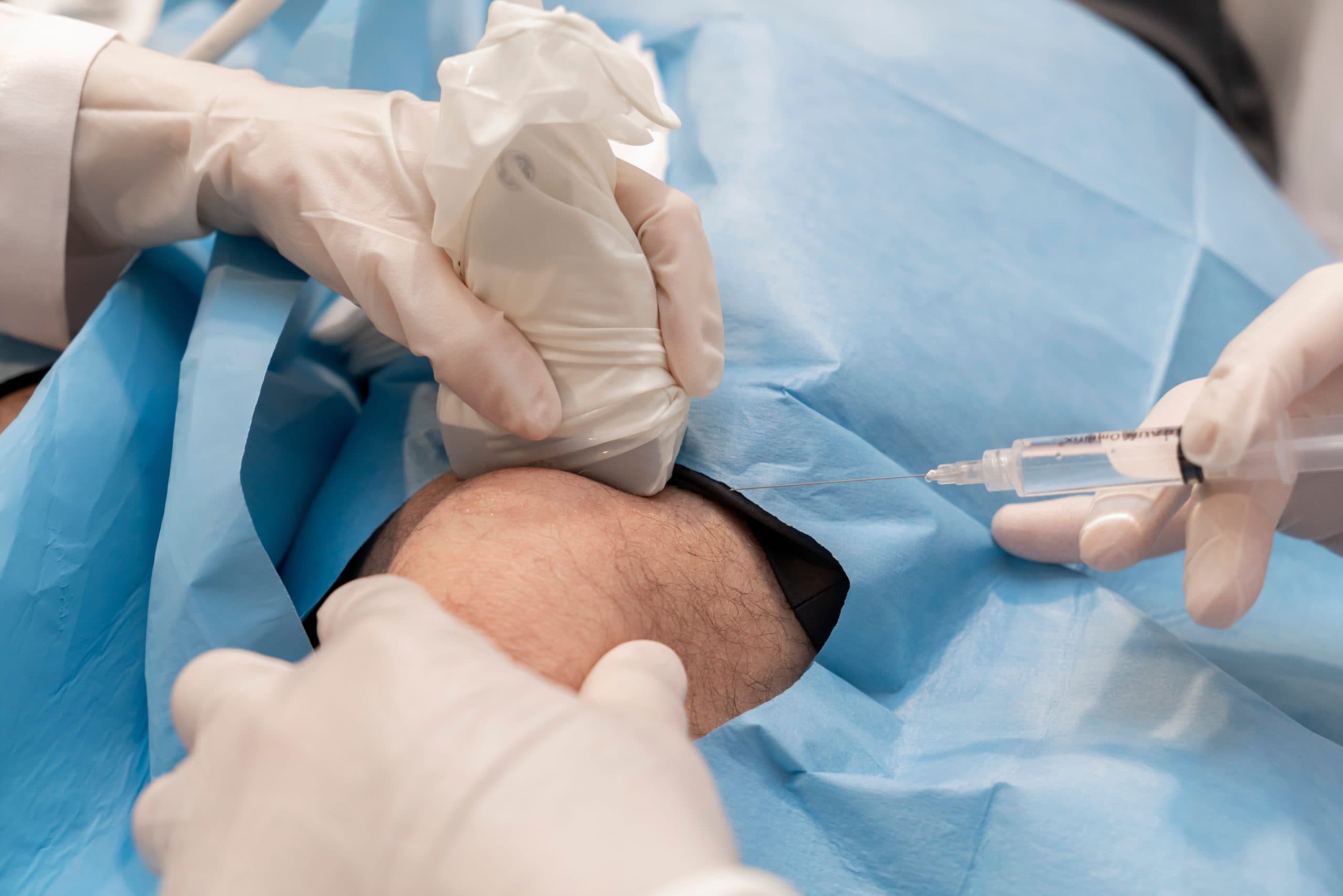 Ultrasound-guided injection into knee joint