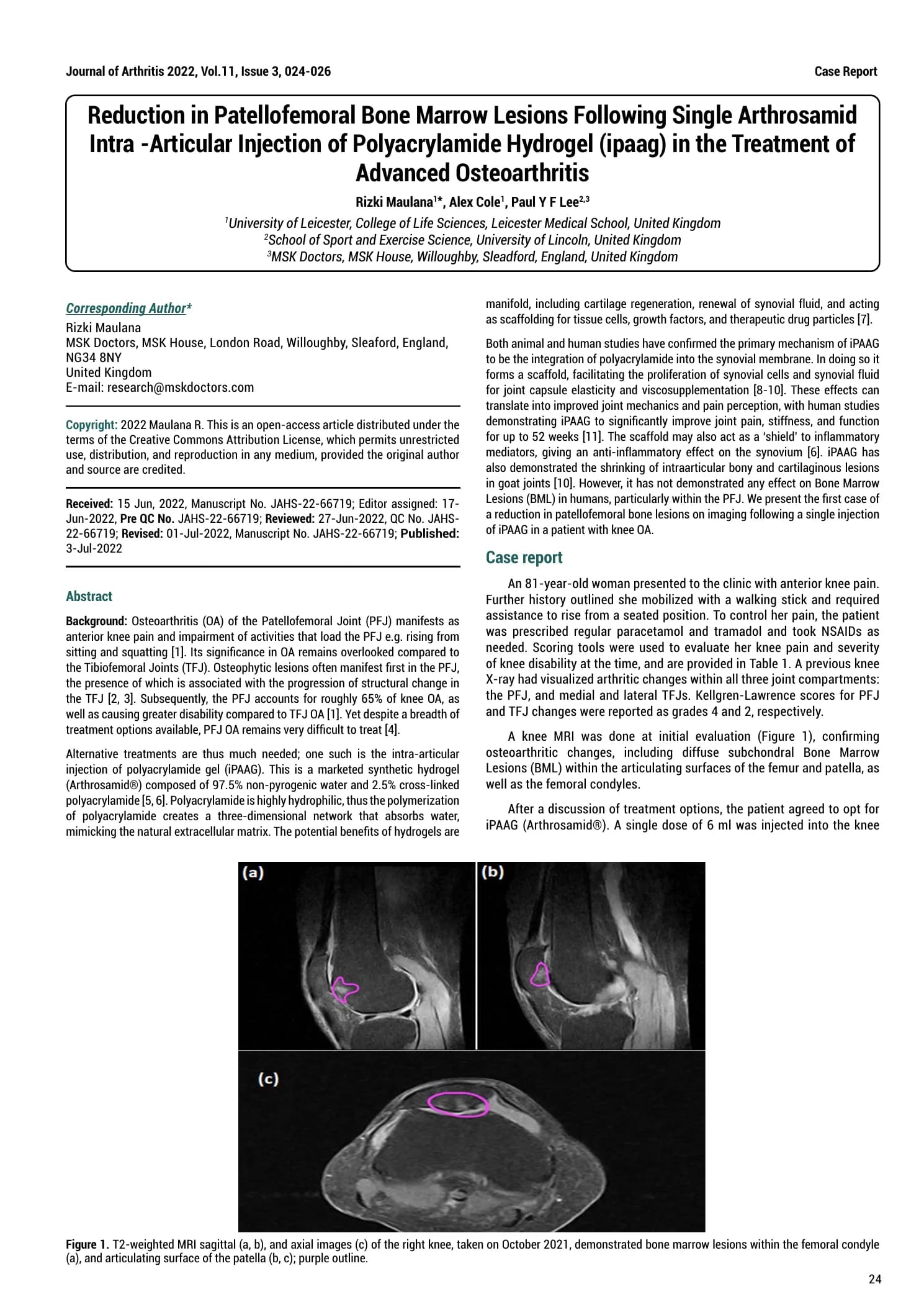 First page of the 2022 Arthrosamid patellofemoral case report