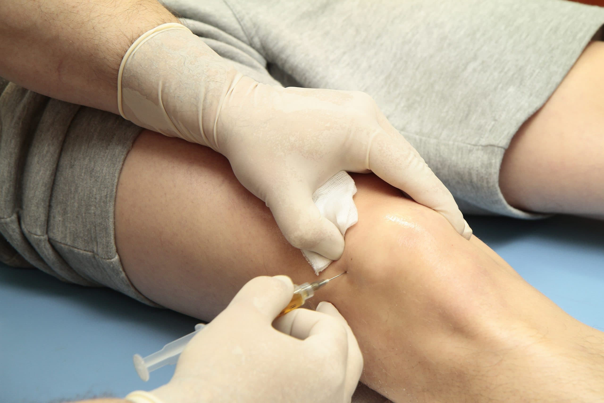 Knee Stem Cell / Medicinal Signaling Cell Therapy