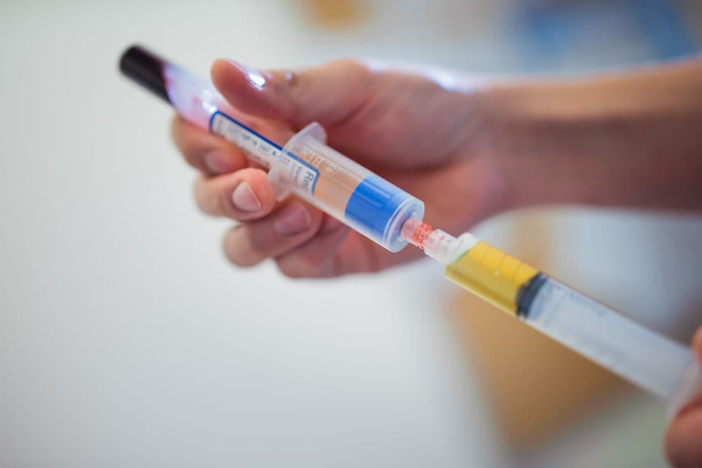 Close-up of syringe preparation for joint injection